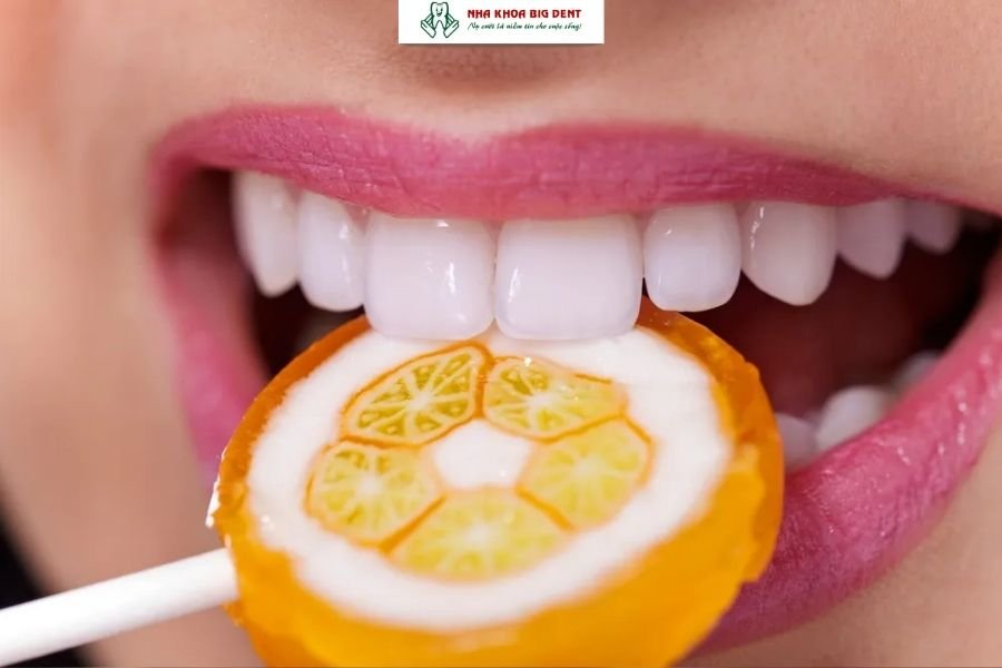 niềng răng trong suốt mất bao lâu