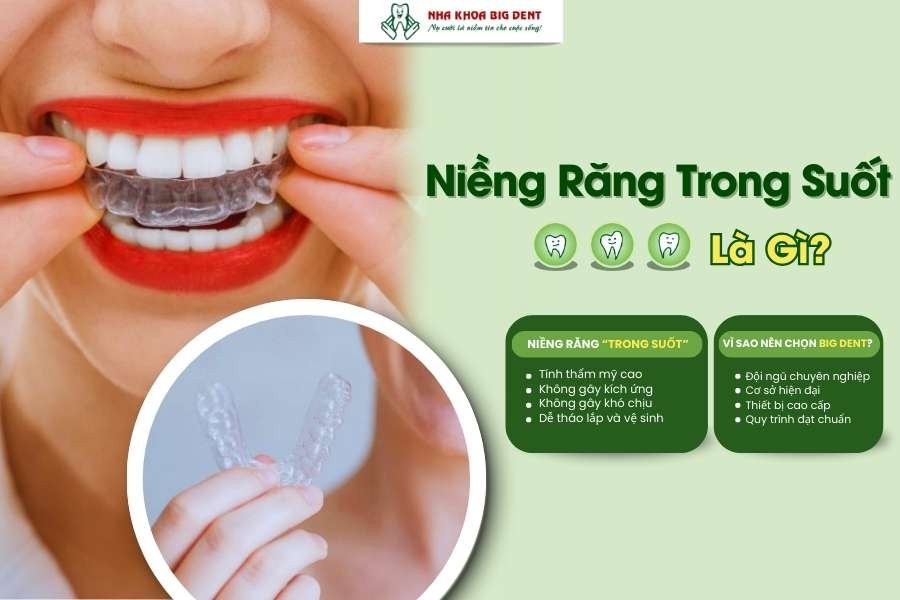 niềng răng trong suốt là gì