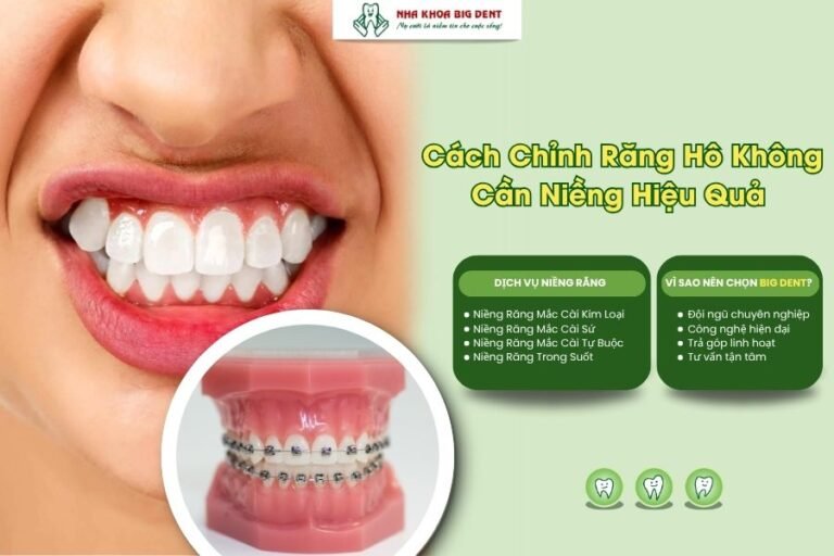 chỉnh răng hô không cần niềng