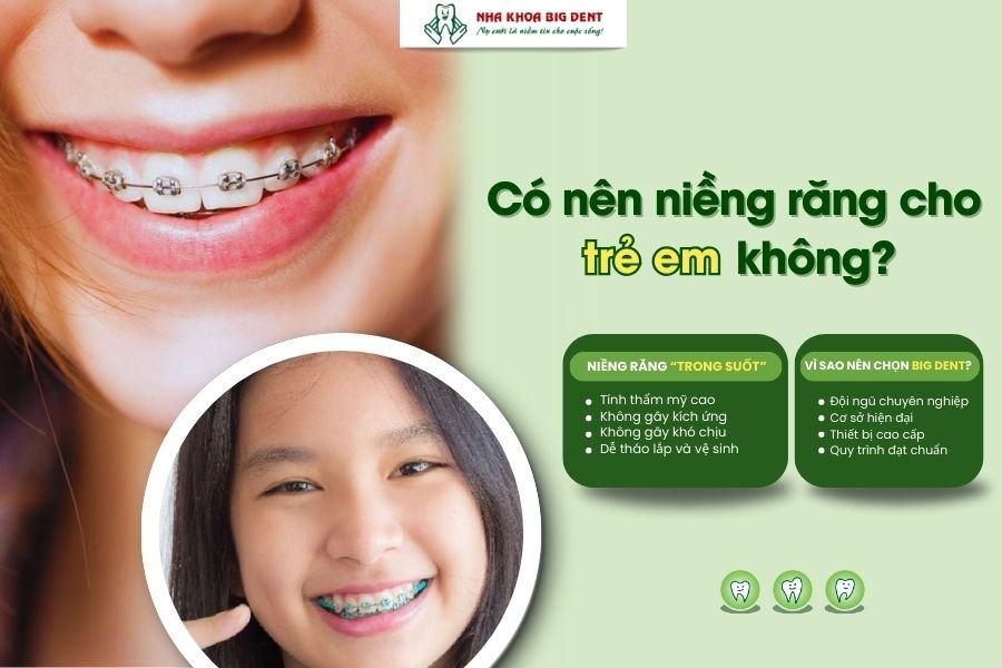 có nên niềng răng cho trẻ em không