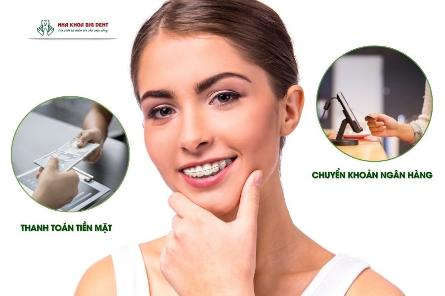 niềng răng trả góp