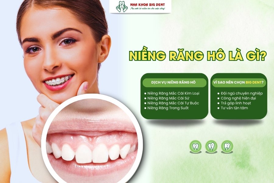 niềng răng hô