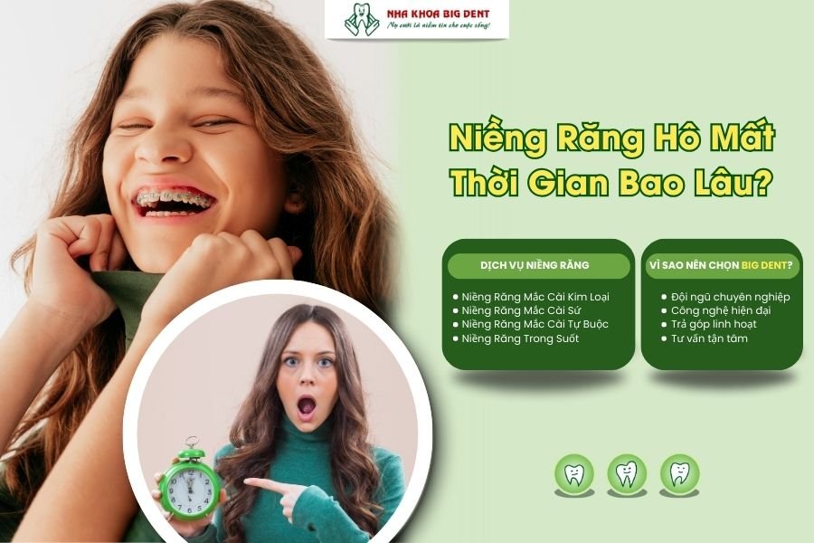 niềng răng hô mất bao lâu