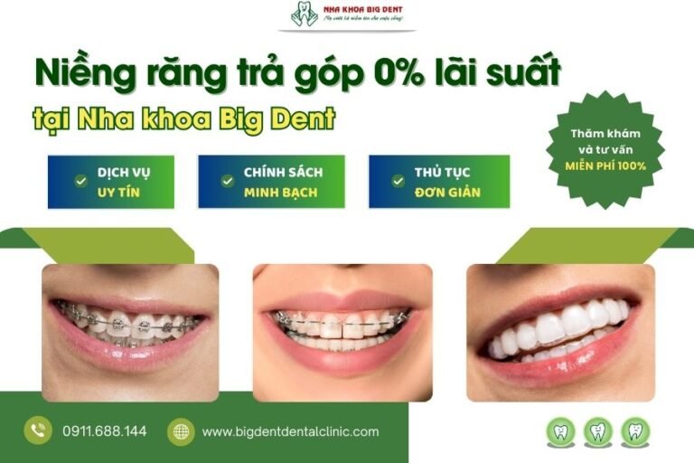 niềng răng trả góp
