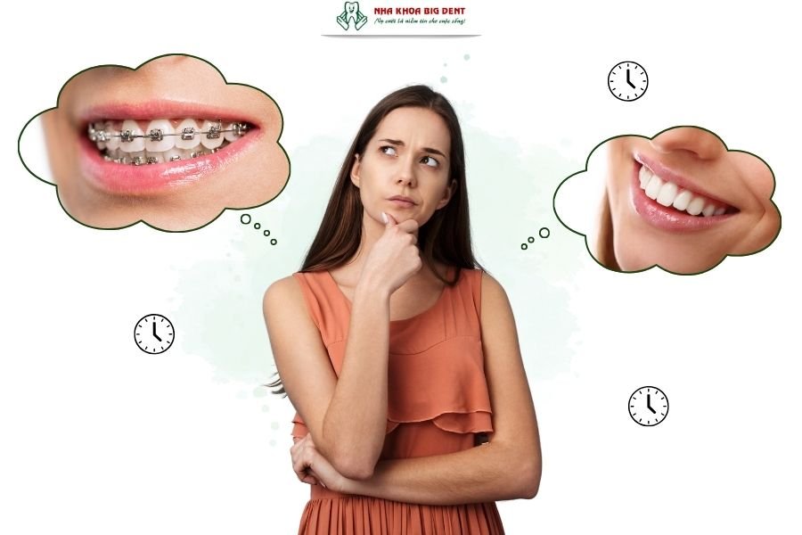 niềng răng hô mất bao lâu