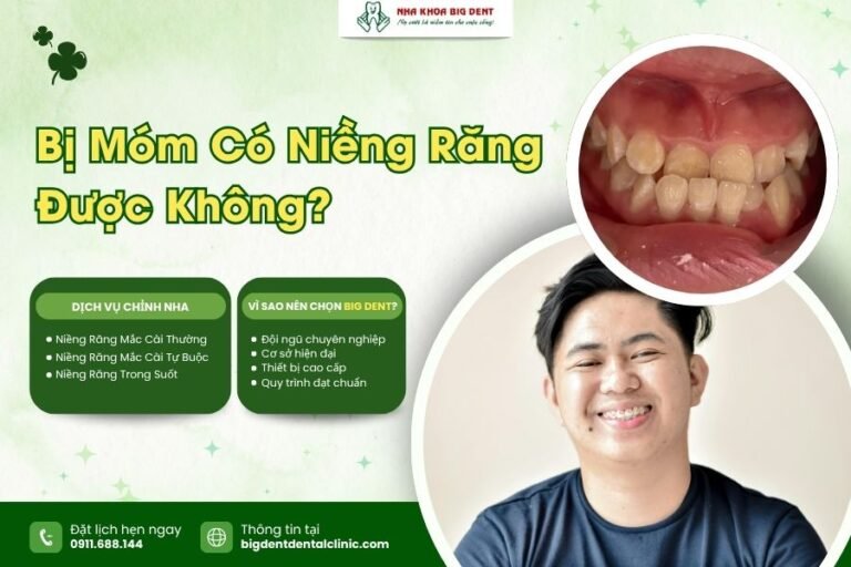 bị móm có niềng răng được không
