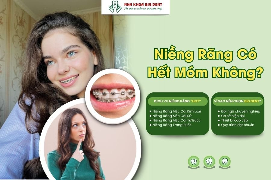 niềng răng có hết móm không