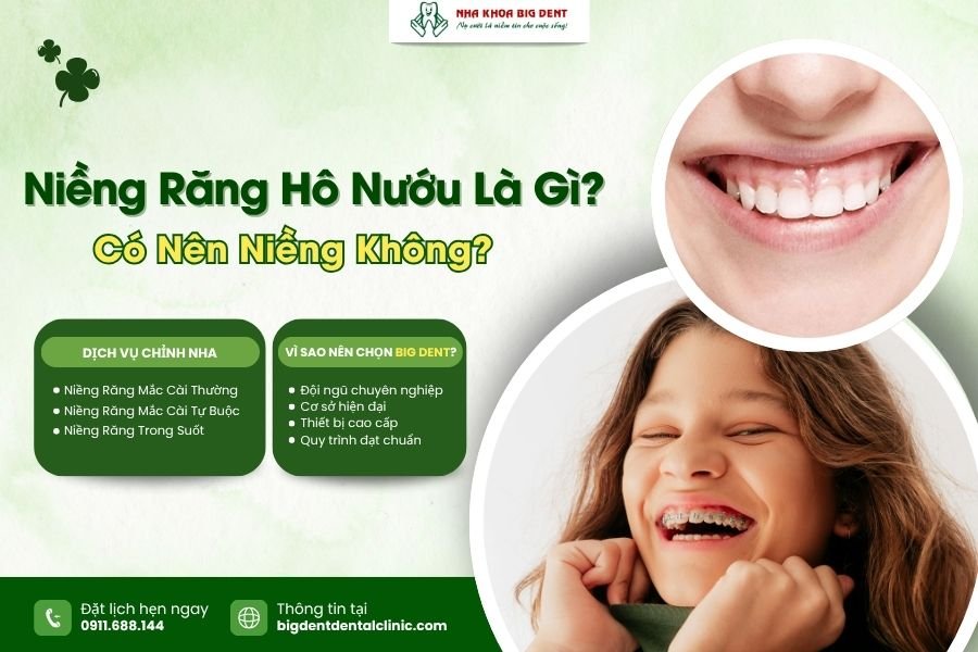niềng răng hô nướu