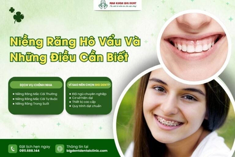 niềng răng hô vẩu