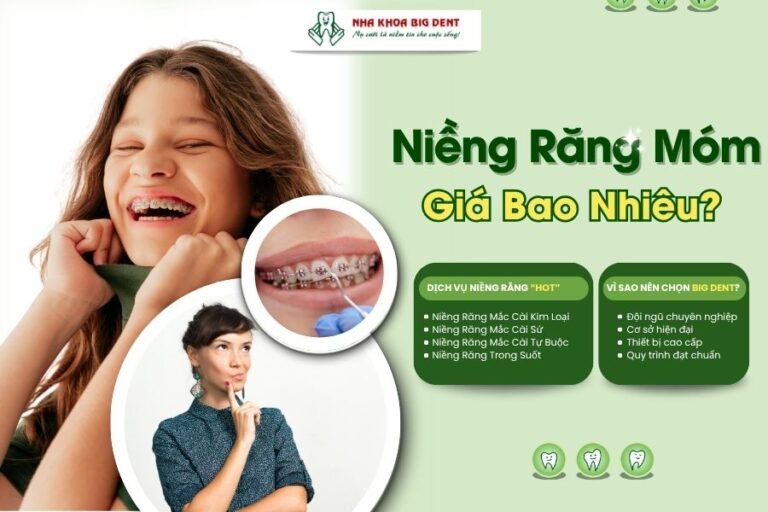 niềng răng móm giá bao nhiêu