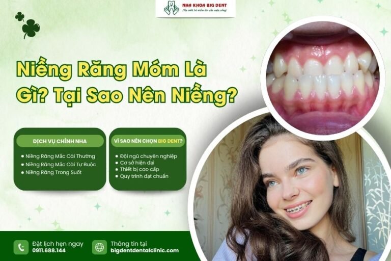 niềng răng móm