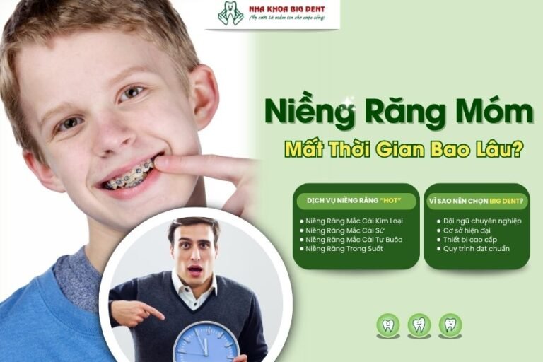 niềng răng móm mất bao lâu