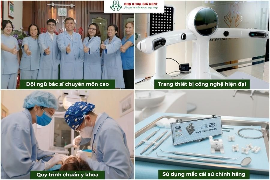 nha khoa big dent