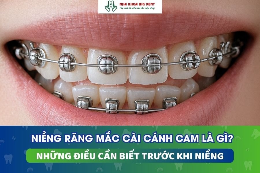 mắc cài cánh cam