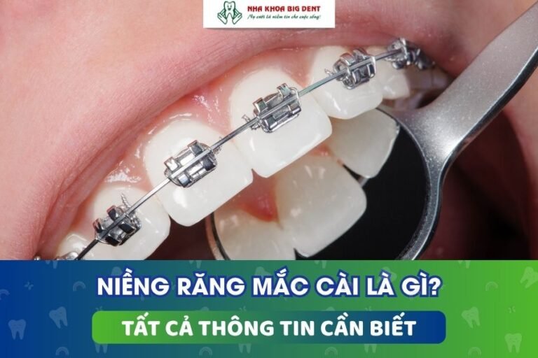 niềng răng mắc cài