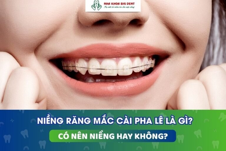 niềng răng mắc cài pha lê