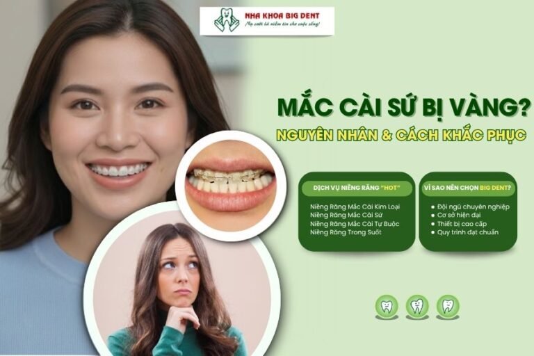 mắc cài sứ bị vàng