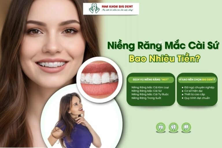 niềng răng mắc cài sứ giá bao nhiêu