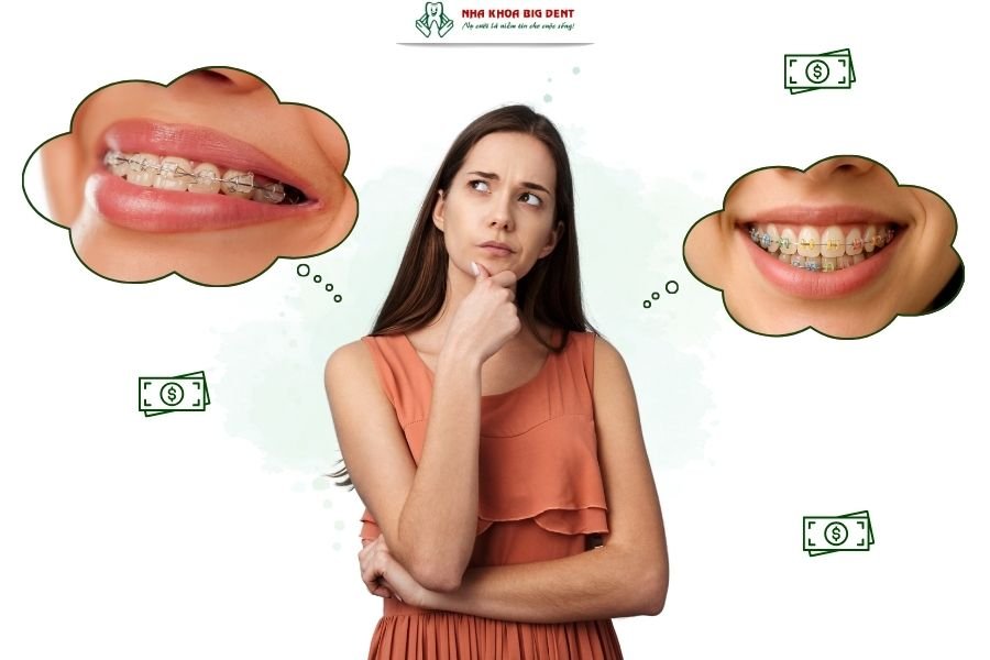 Niềng răng mắc cài sứ giá bao nhiêu