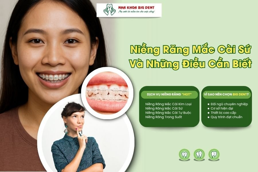 niềng răng mắc cài sứ