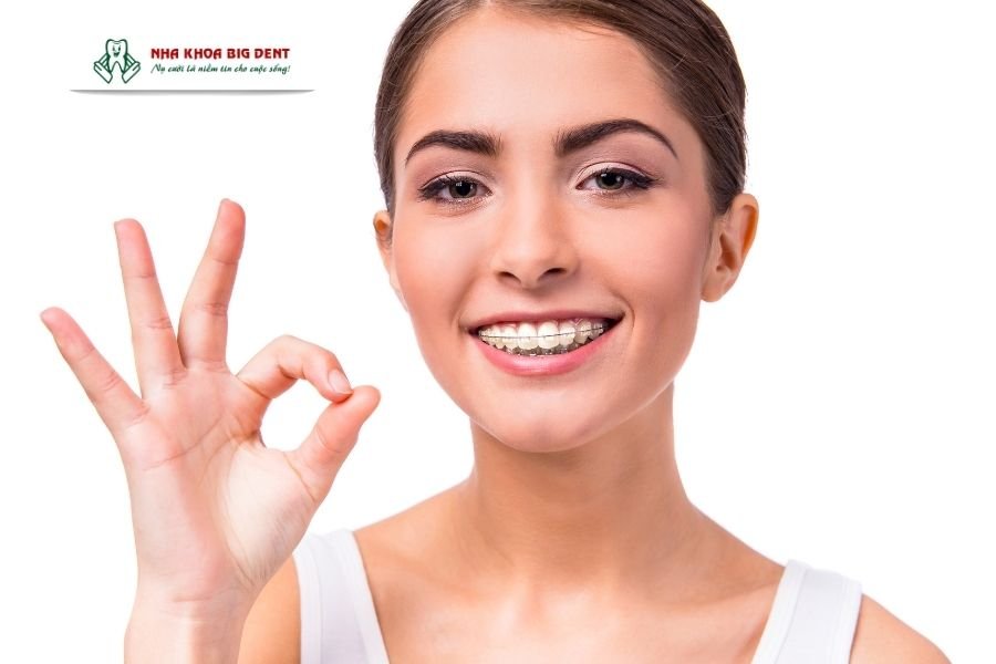 niềng răng mắc cài sứ