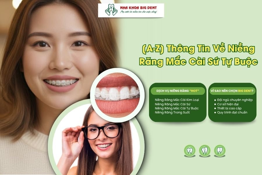 niềng răng mắc cài sứ tự buộc