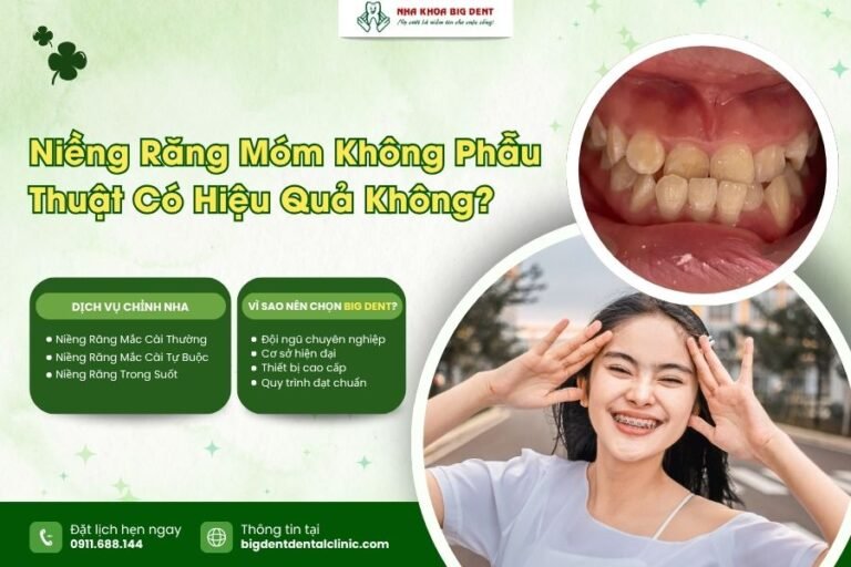 niềng răng móm không cần phẫu thuật