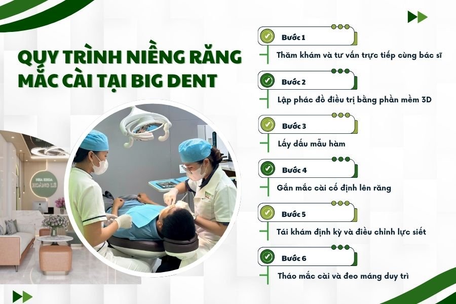 quy trình niềng răng mắc cài