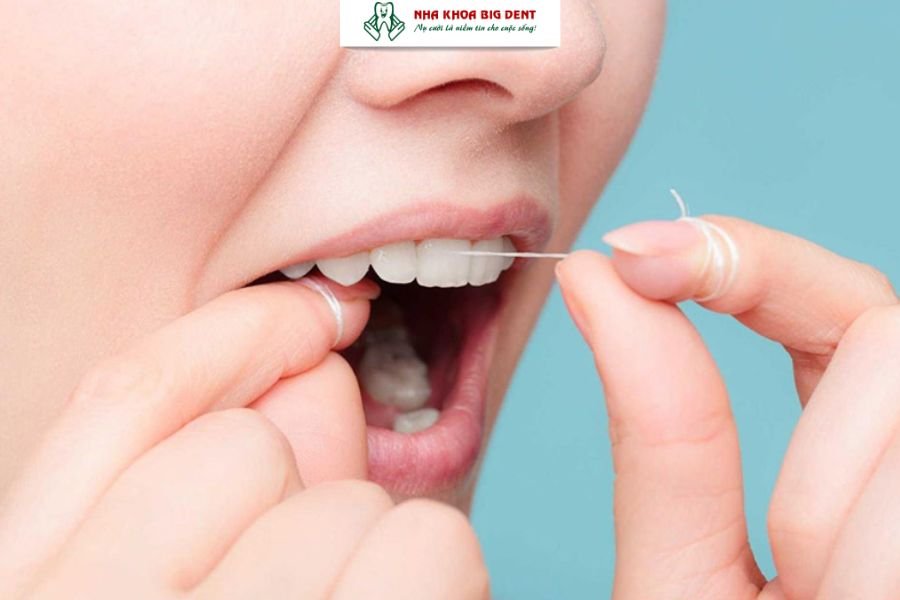 vệ sinh răng bọc sứ