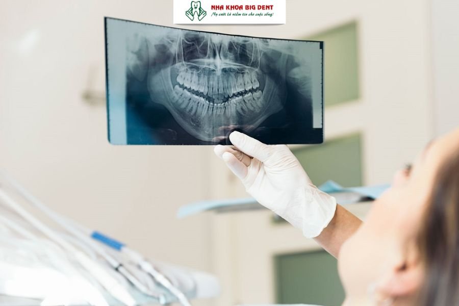 Chụp X-quang răng miệng