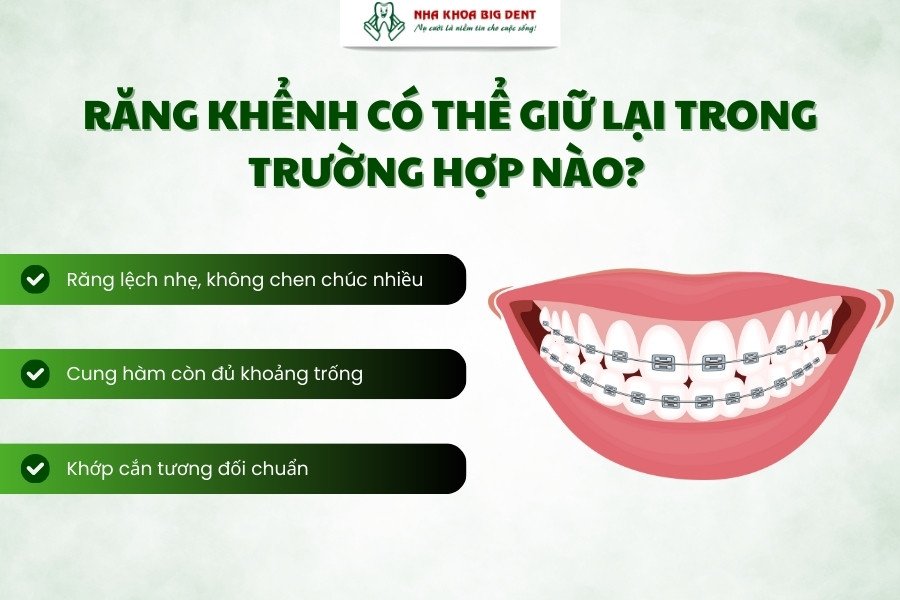 niềng răng giữ lại răng khểnh có được không