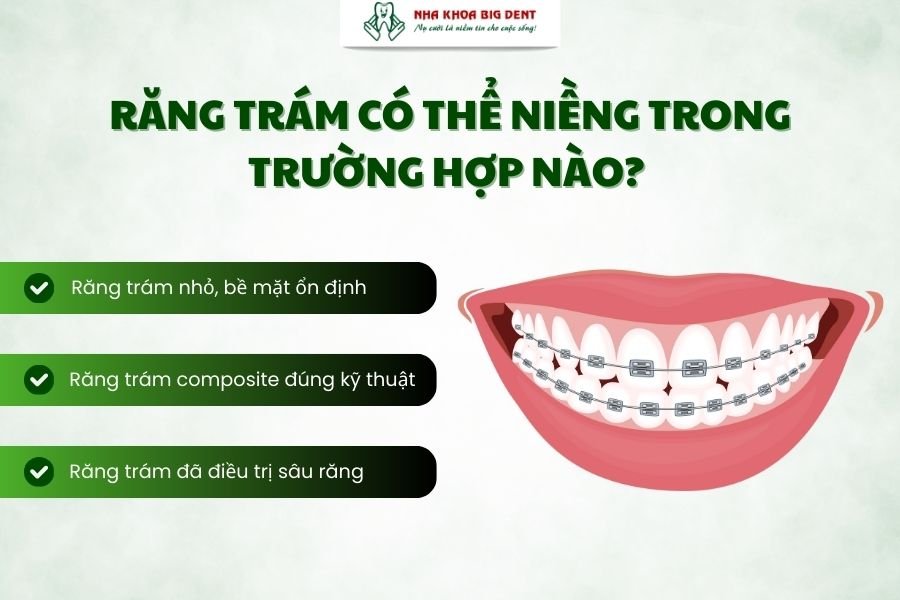 răng trám có niềng được không