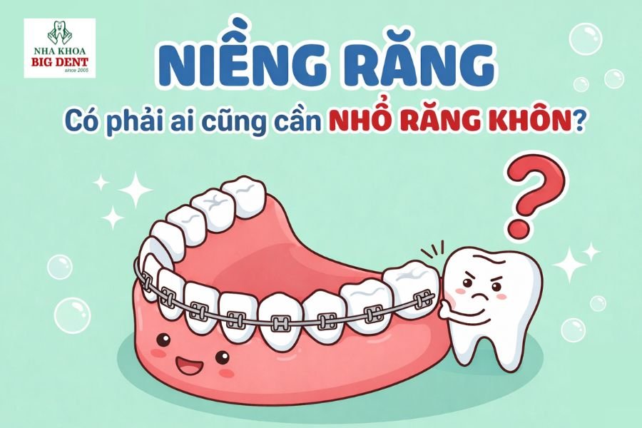 niềng răng có cần nhổ răng khôn không