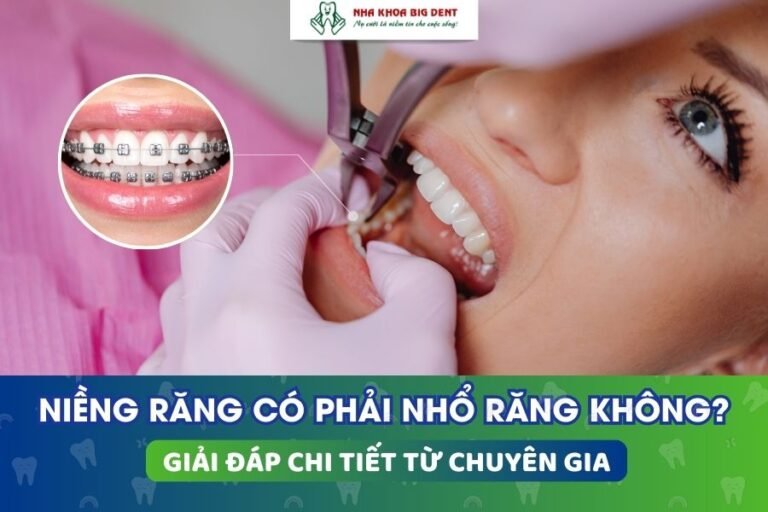 niềng răng có phải nhổ răng không