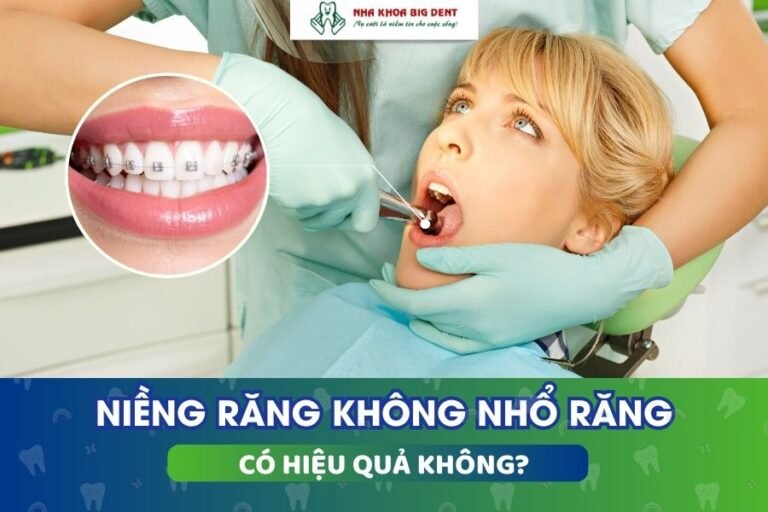 niềng răng không nhổ răng có hiệu quả không