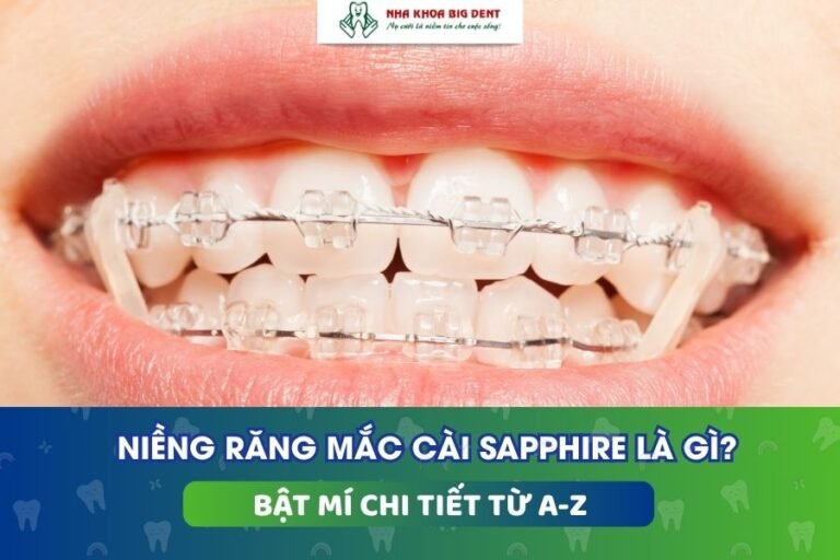niềng răng mắc cài sapphire