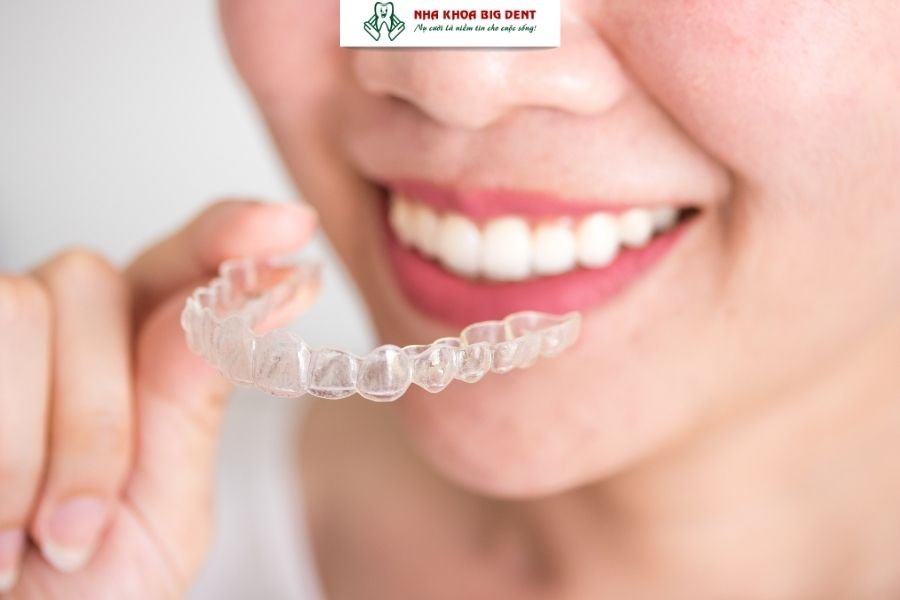 niềng răng trong suốt