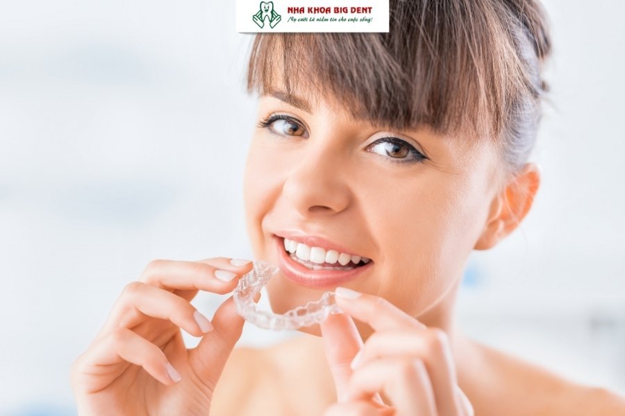 niềng răng trong suốt