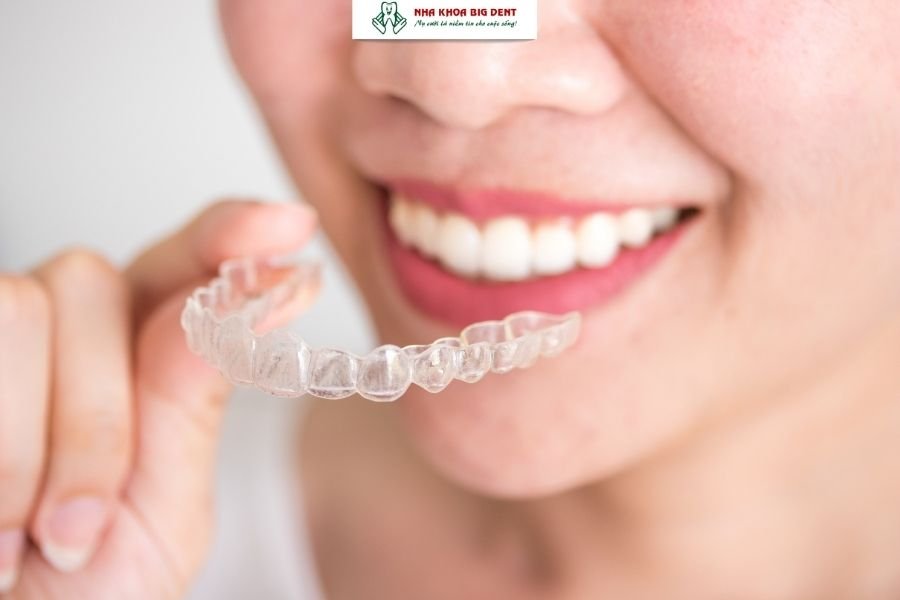 niềng răng trong suốt