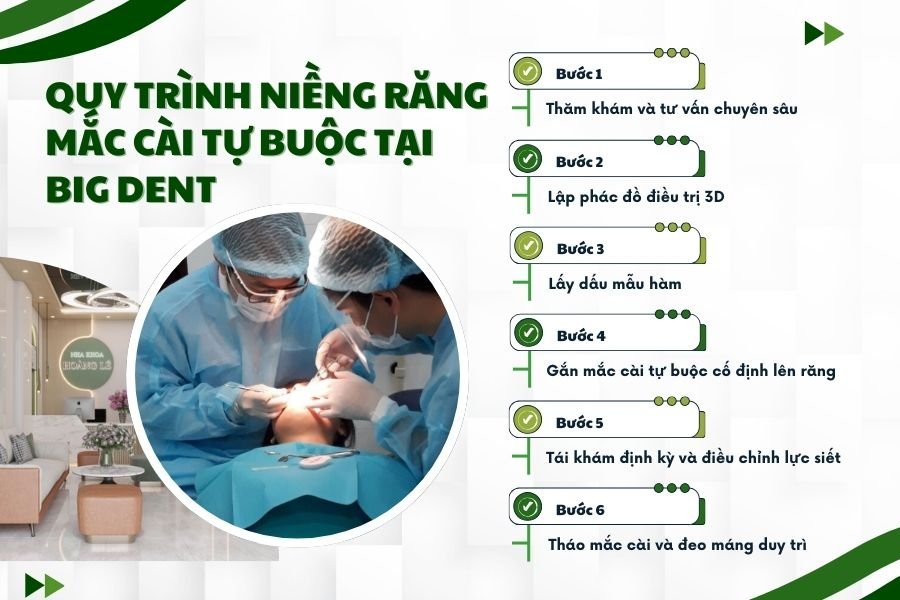 quy trình niềng răng mắc cài tự buộc