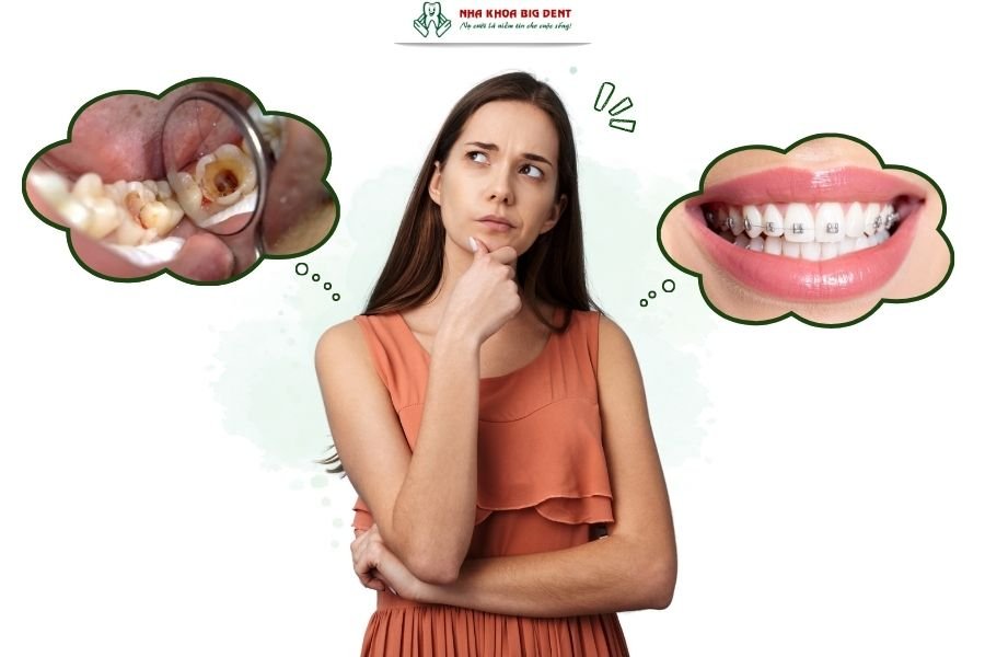 răng đã lấy tủy có niềng được không