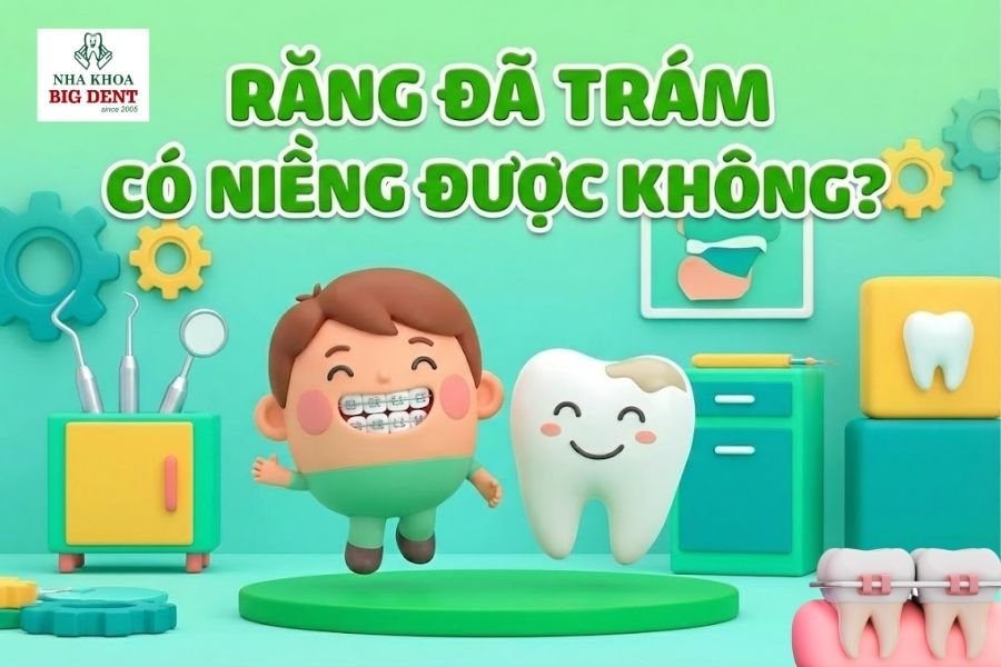 răng trám có niềng được không