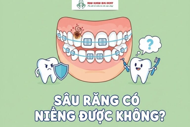 sâu răng có niềng được không