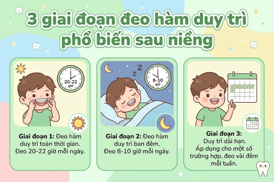 niềng răng đeo hàm duy trì bao lâu