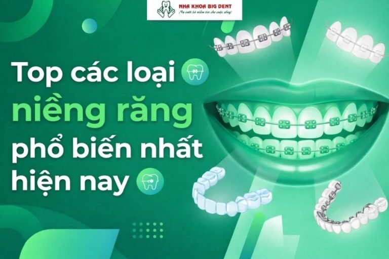 các loại niềng răng