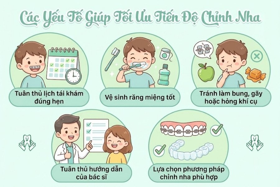 niềng răng mất bao lâu