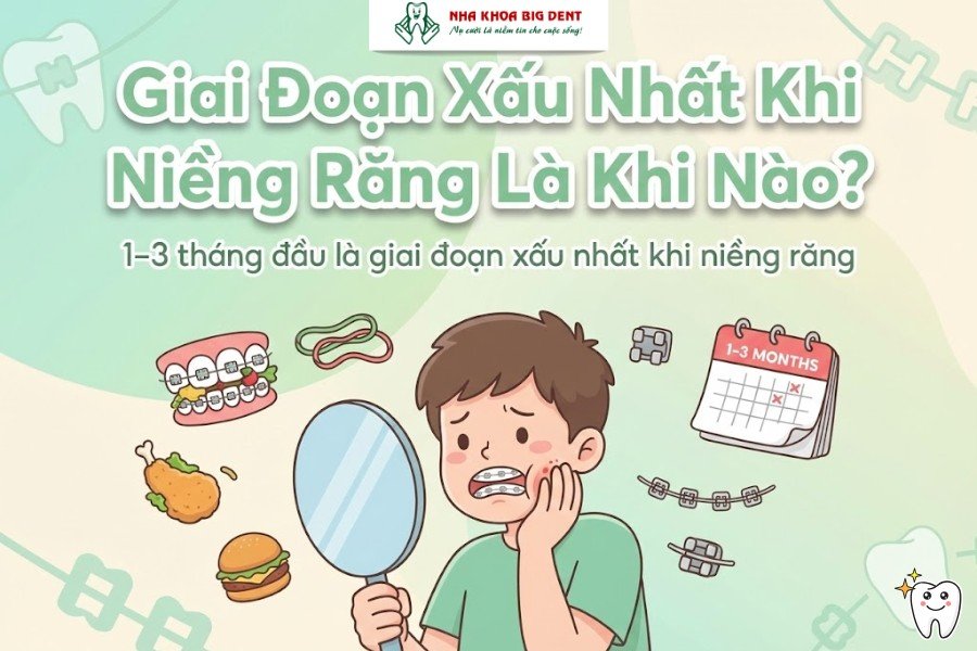 giai đoạn xấu nhất khi niềng răng