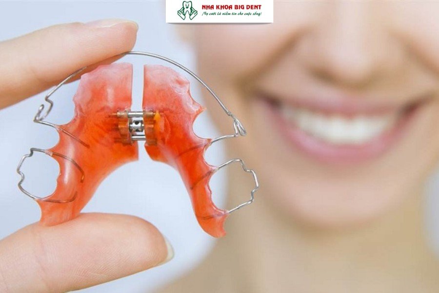 Hàm duy trì tháo lắp kim loại