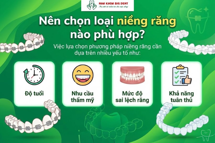 các loại niềng răng