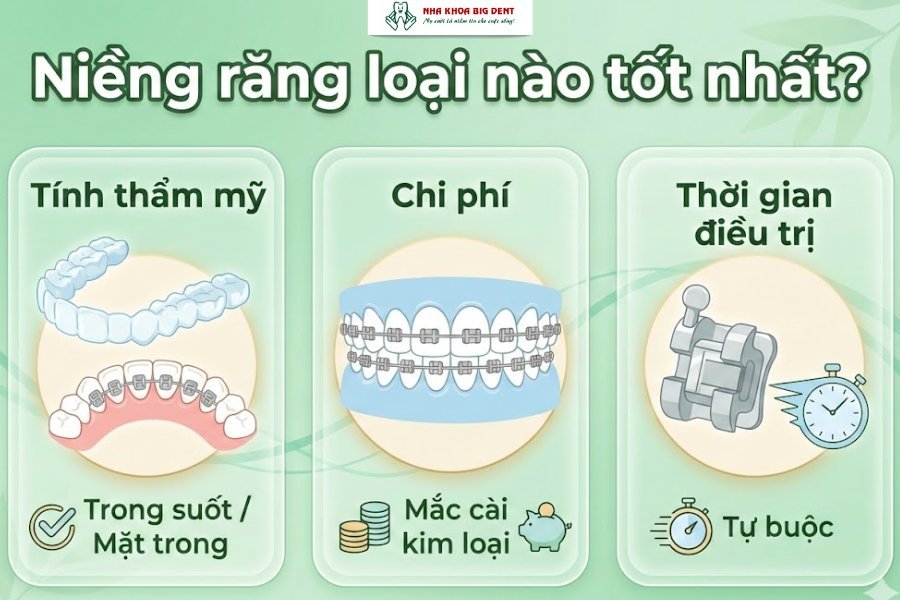 niềng răng loại nào tốt nhất